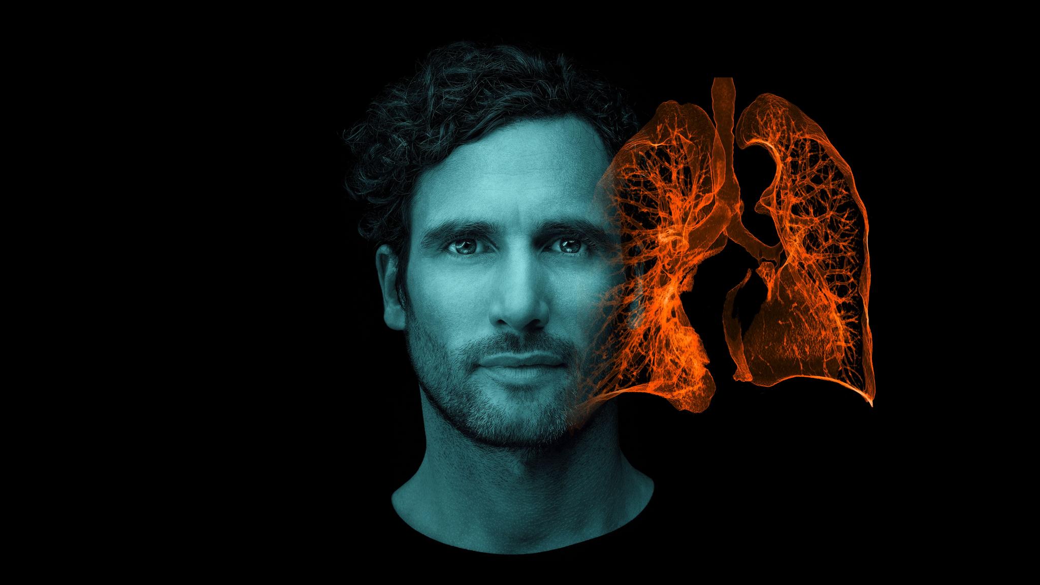 Lung Cancer Webinars Siemens Healthineers