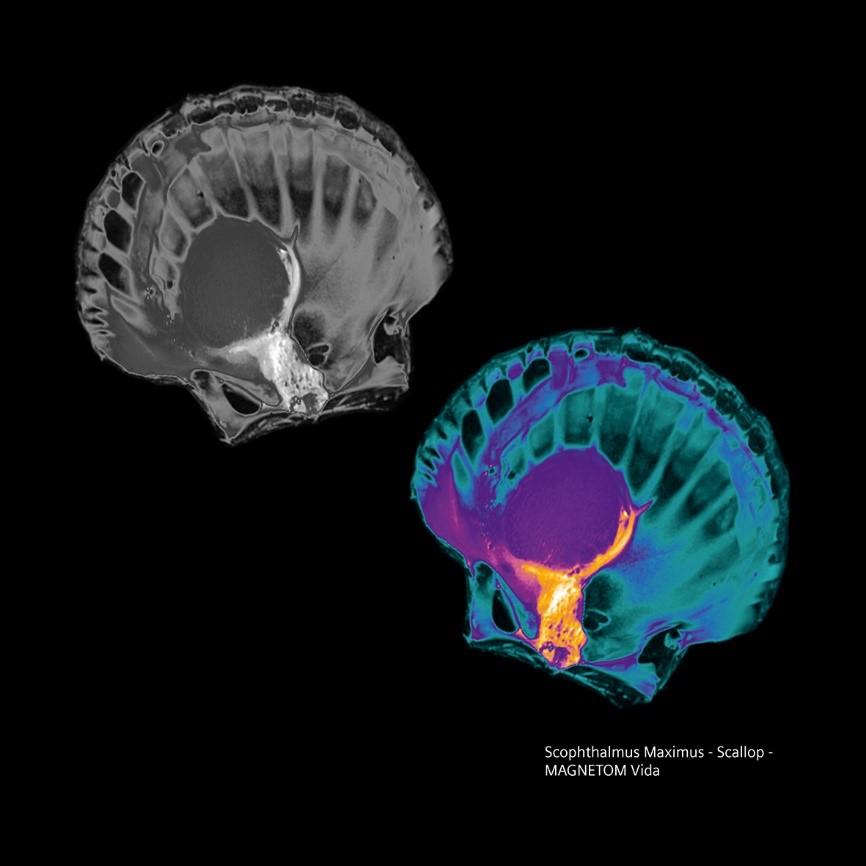 Siemens-healthineers_Magnetomworld_scallop_Vida