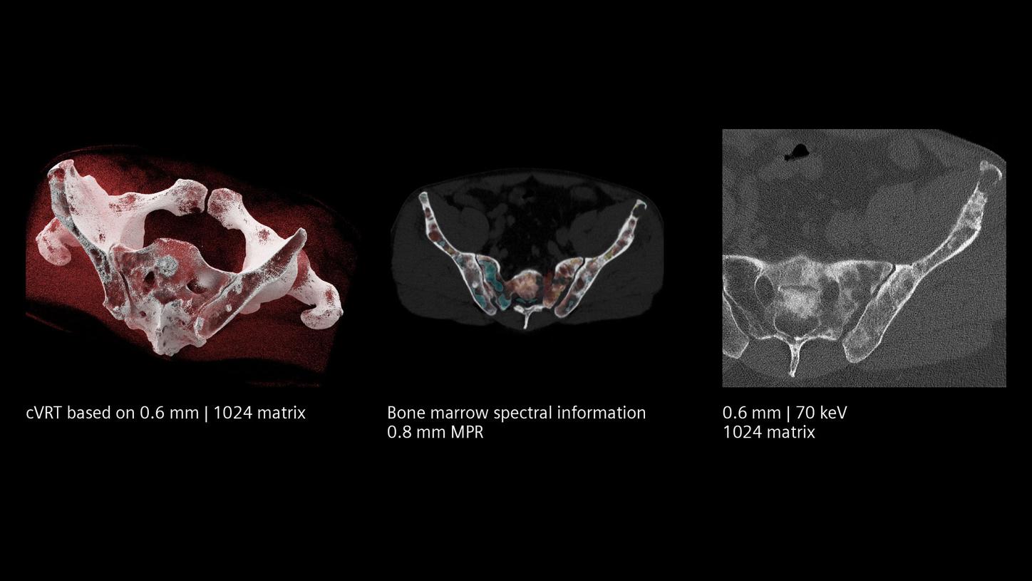 Clinical images of an evaluation of bone marrow, part 2