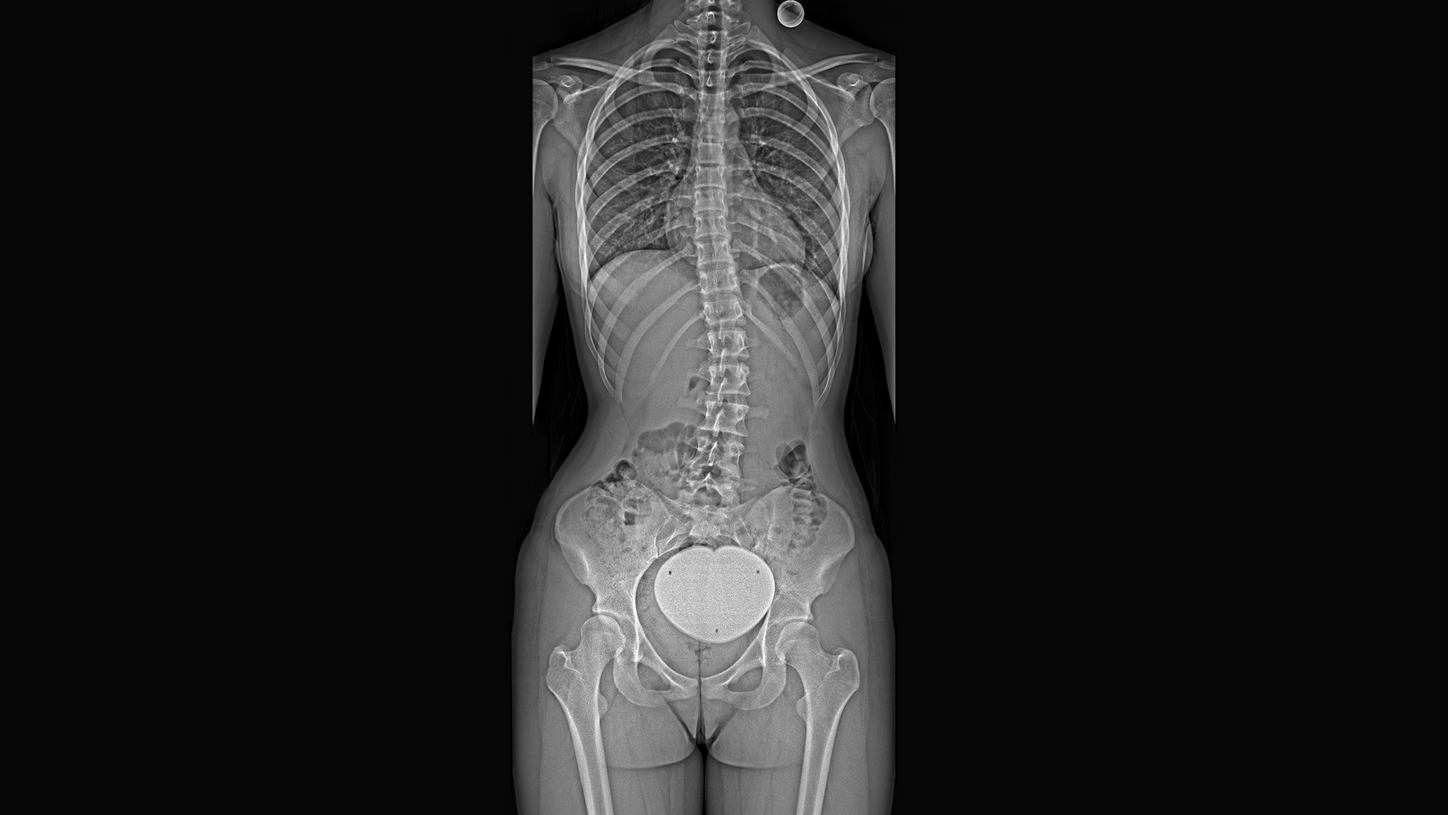 Understand compensation mechanisms