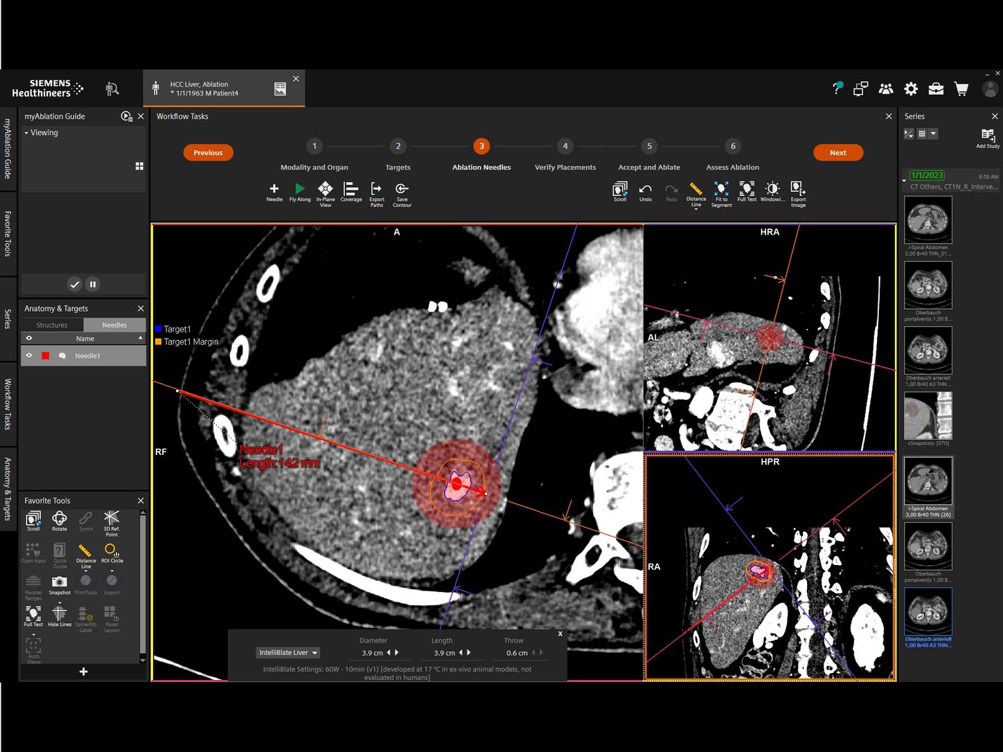 Dynamic 3D needle planning and verification