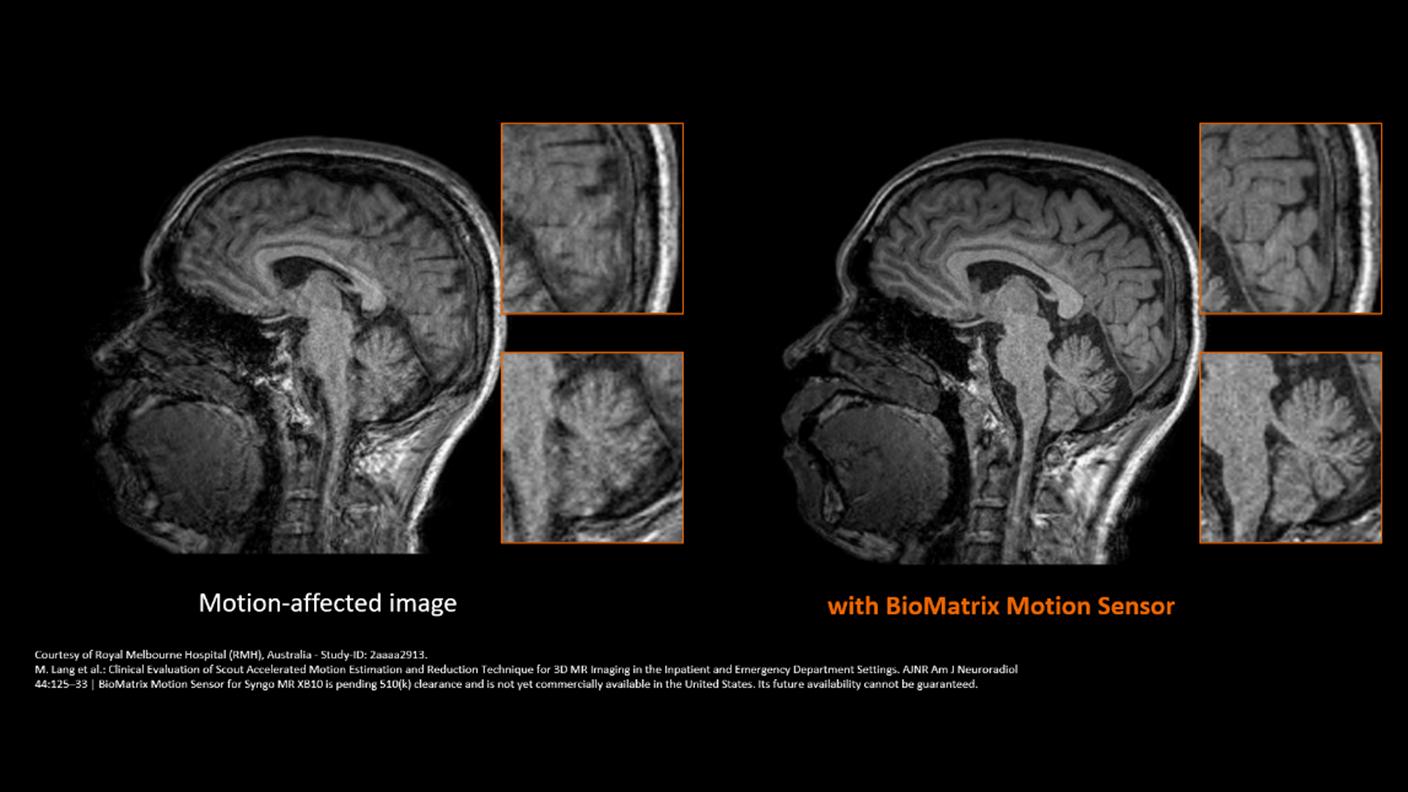 PR MAGNETOM Vida and Lumina Pro Edition Clinical Neuro