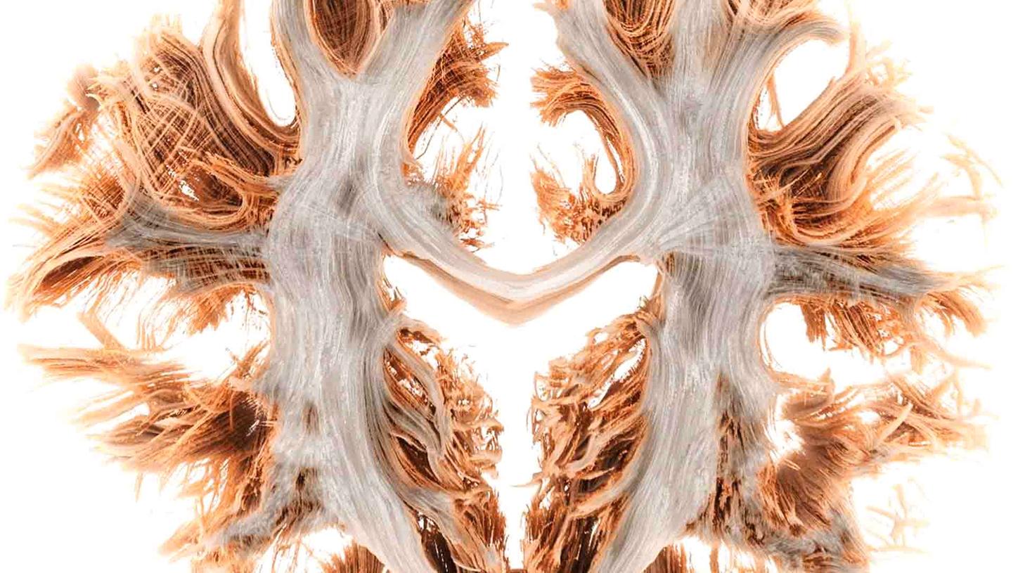 Postprocessing for MR