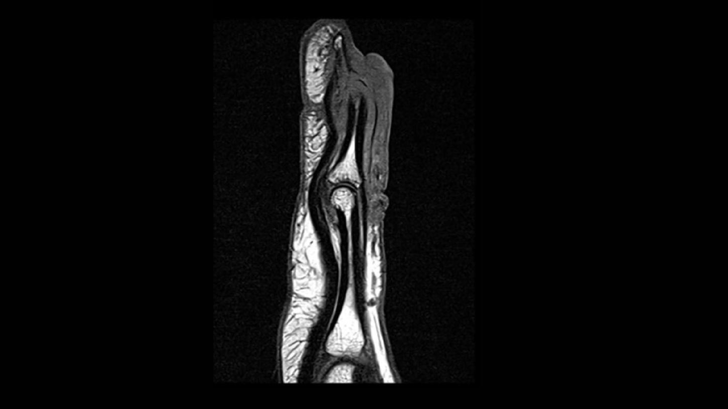 msk mri