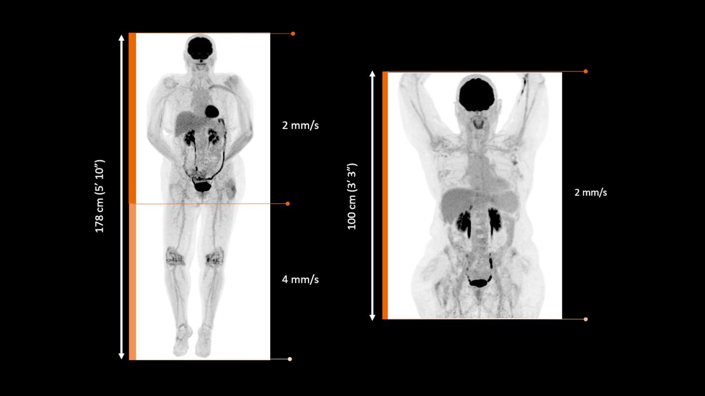 Biograph Trinion.X with FlowMotion brings boundless imaging for multi field-of-view studies