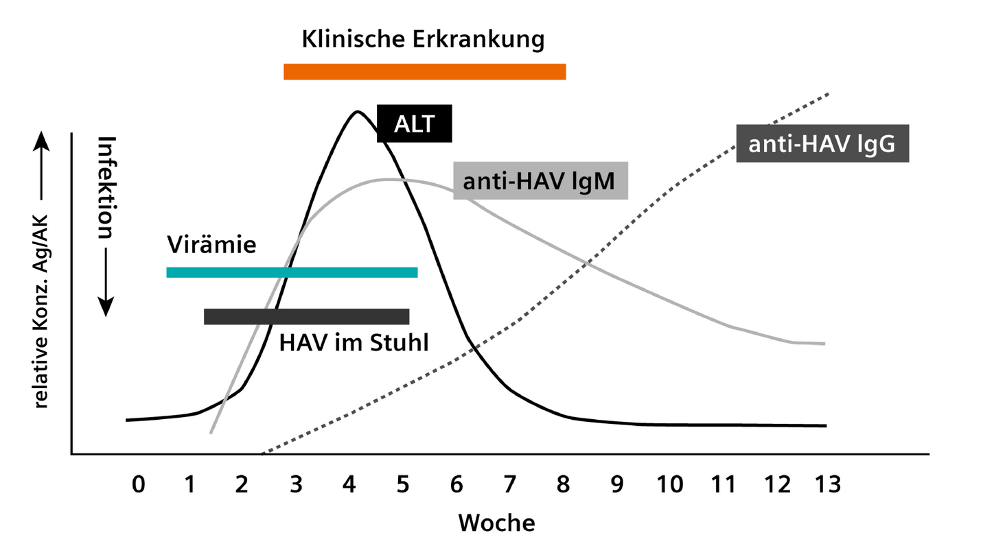 Siemens Healthineers Hepatitis A Assay