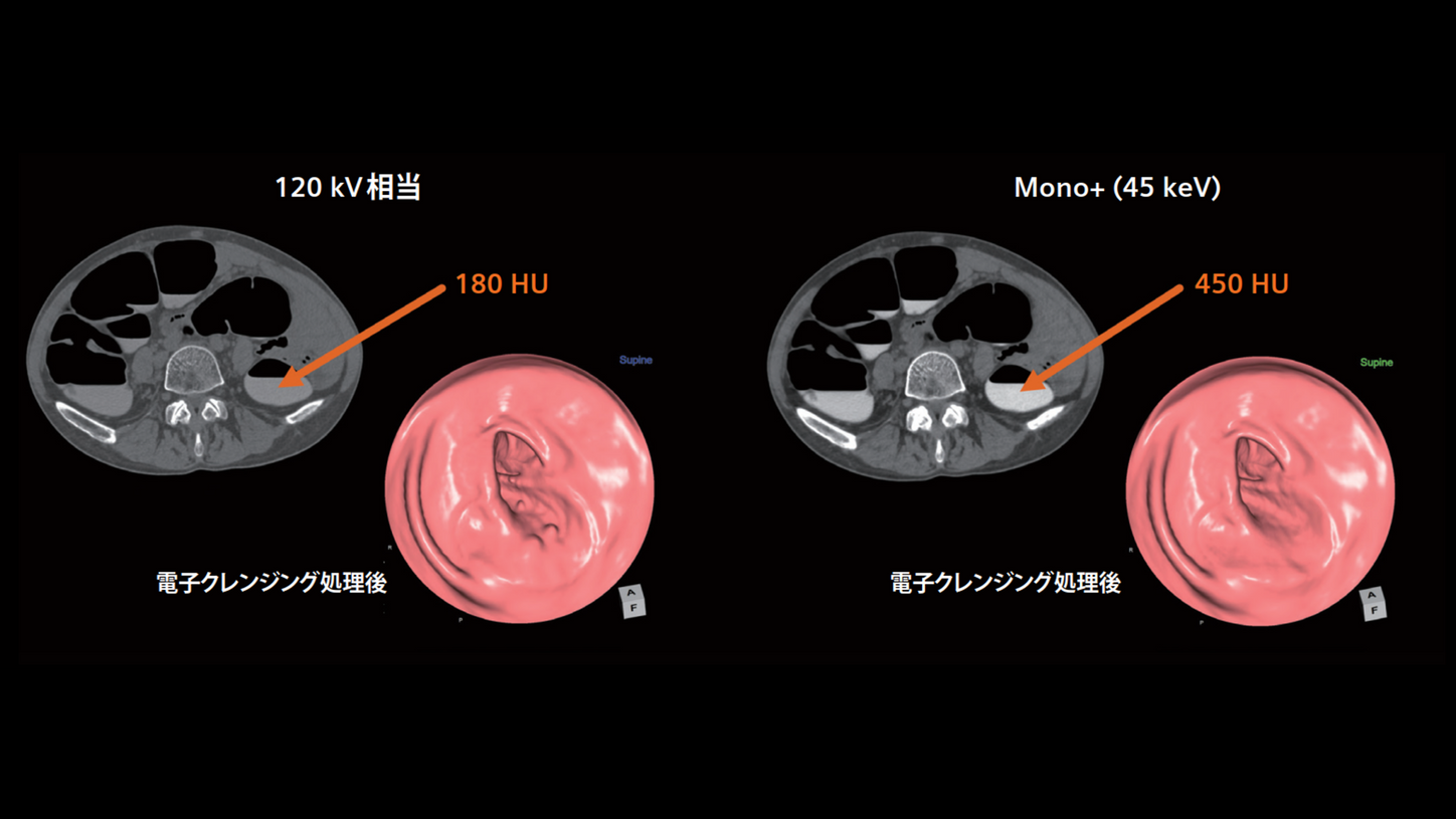 JP-CT-Pro.Pulse_CaseRport_vol.4-3