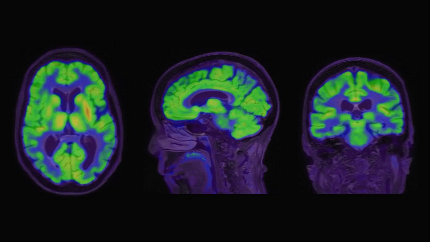 PET/CT - header case study