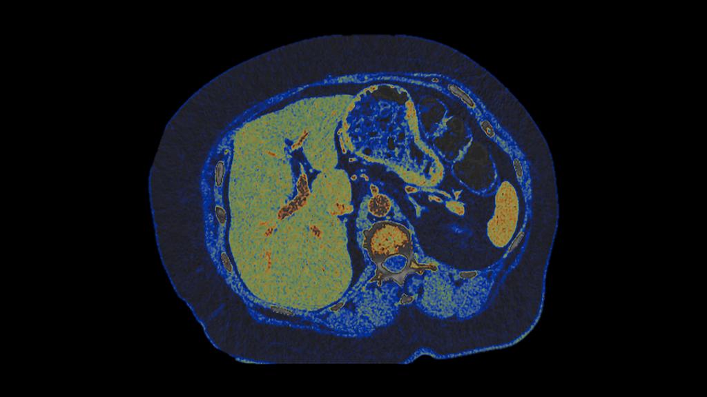 PCCT scientific evidence - Siemens Healthineers