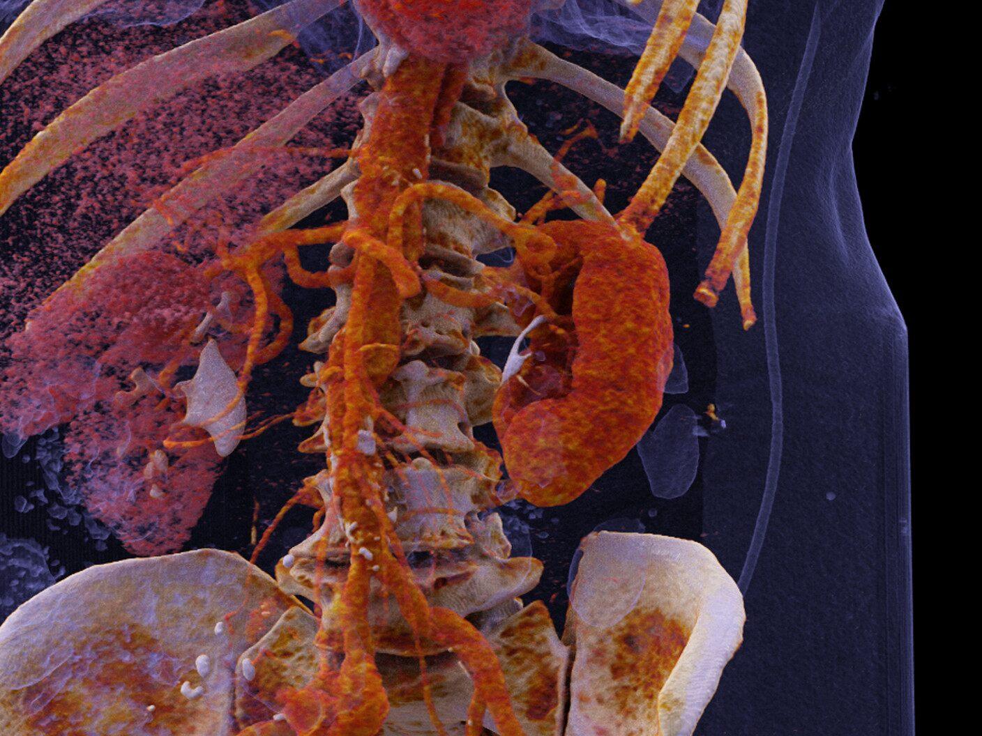 View of internal organs with Dual Source technology