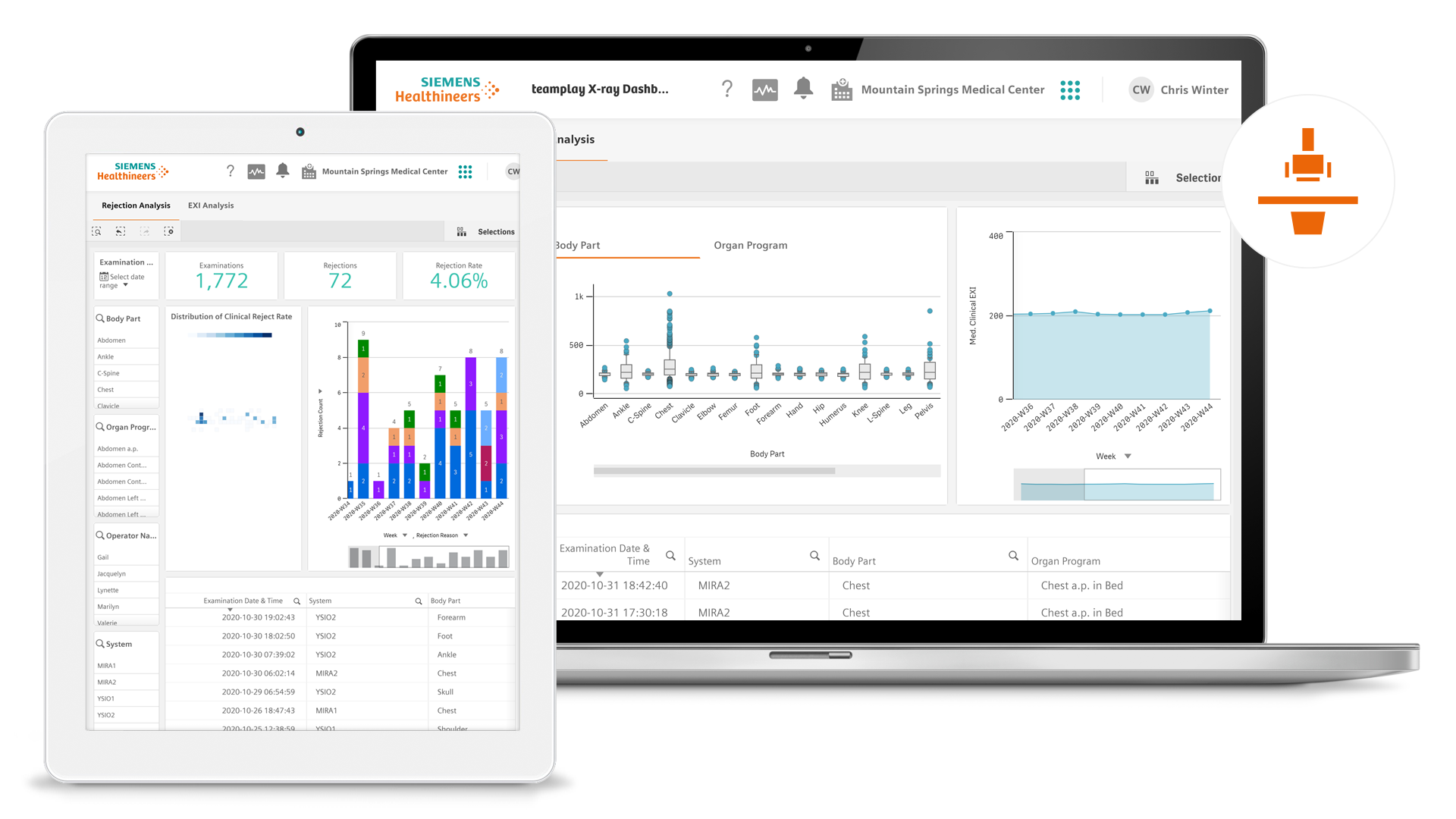 teamplay-x-ray-dashboard-reject-analysis-on-radiography-siemens