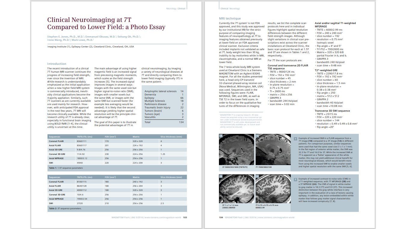 Siemens-healthineers_Magnetomworld_clinical-neuroimaging1