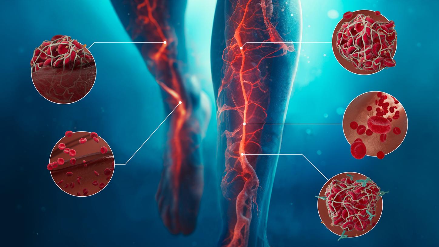 Hemostasis Learning Essentials