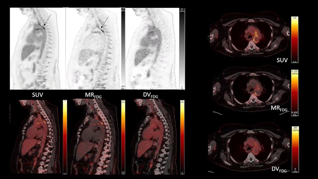 Total-body multiparametric PET/CT allows clinician researchers to see ...