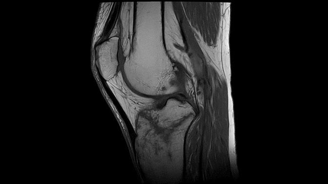 Knee with MAGNETOM Altea